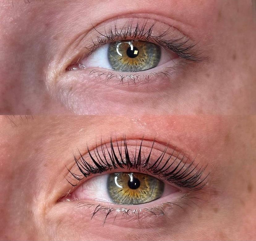 Lashlifting